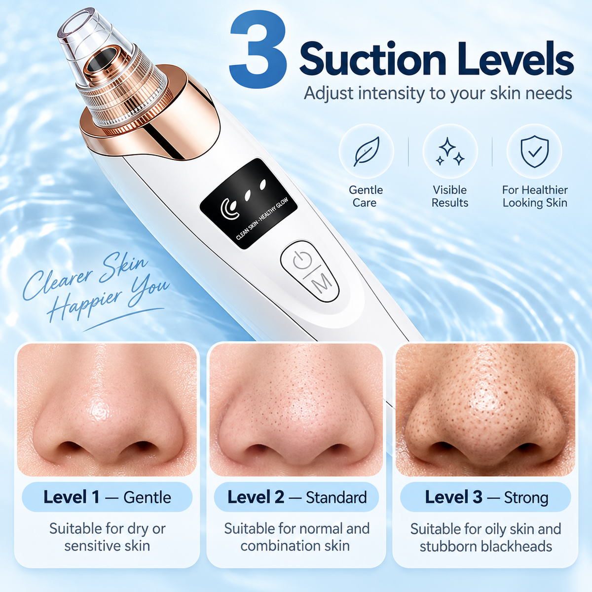 Blackhead remover