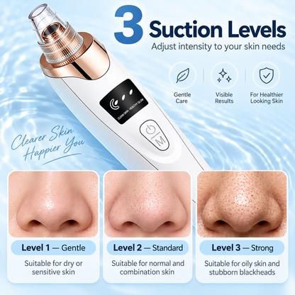 Blackhead remover