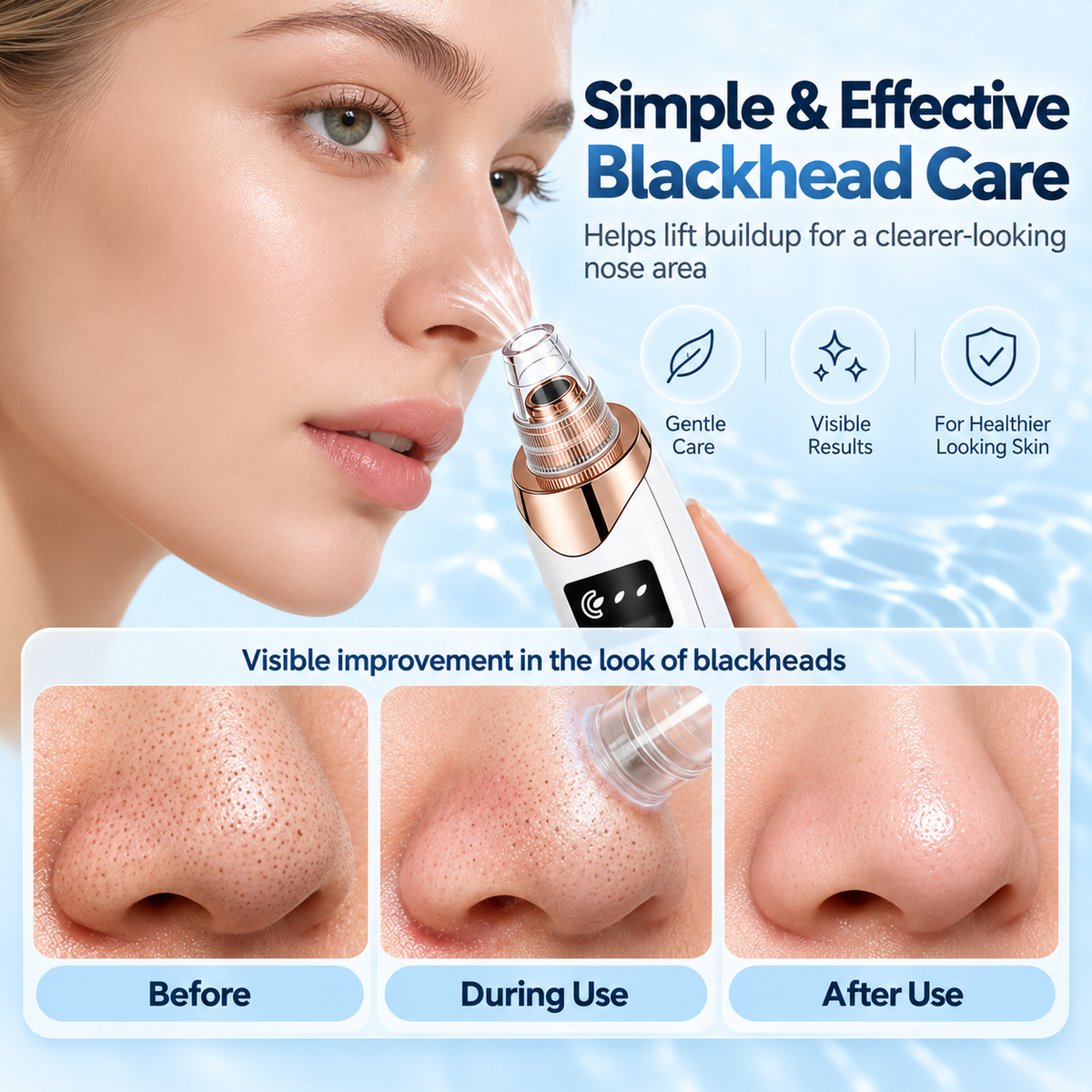 Blackhead remover