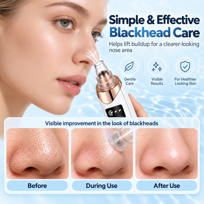 Blackhead remover